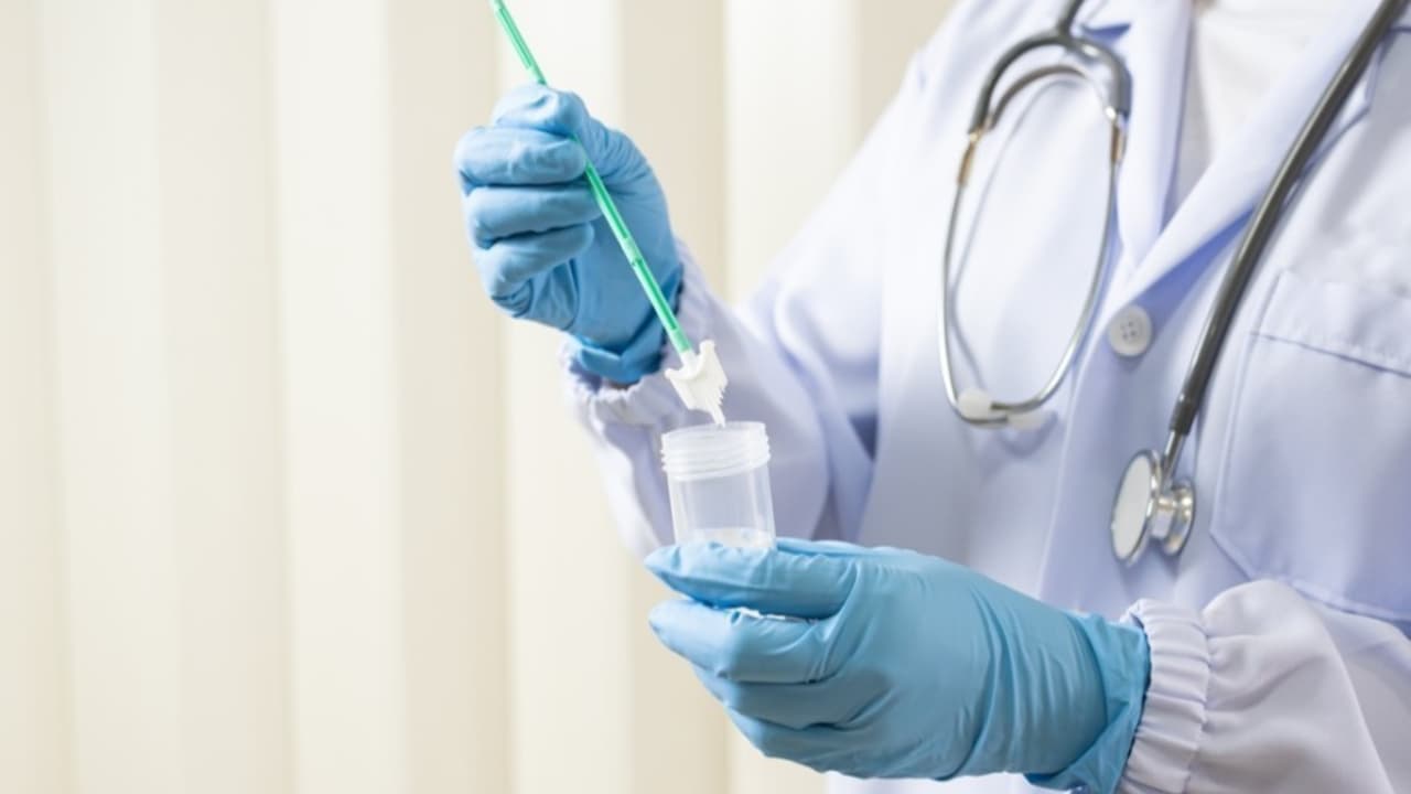 Koniec cytologii na NFZ. Nowy test ma wykryć raka wcześniej 20