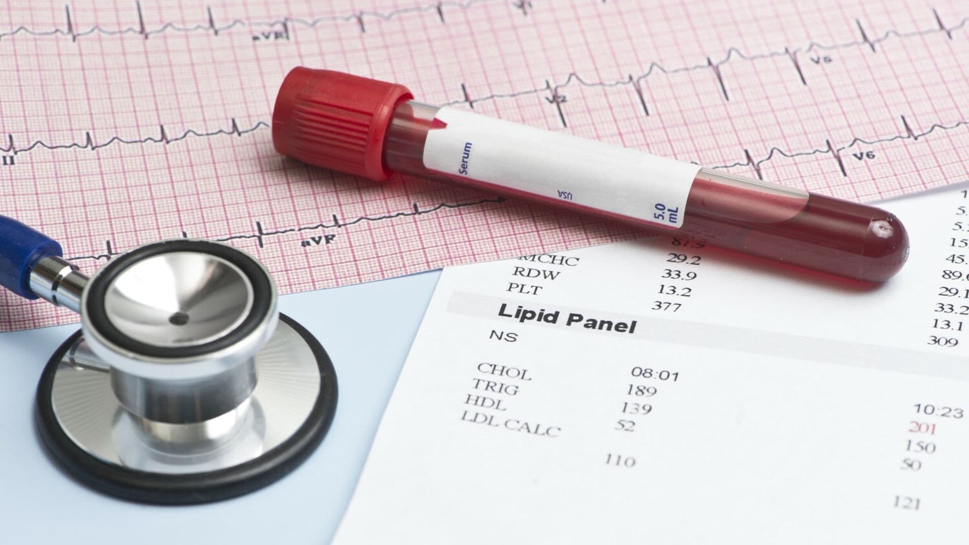 Zmiany w badaniach cholesterolu. ‘Dobry’ HDL nie jest już kluczowym parametrem