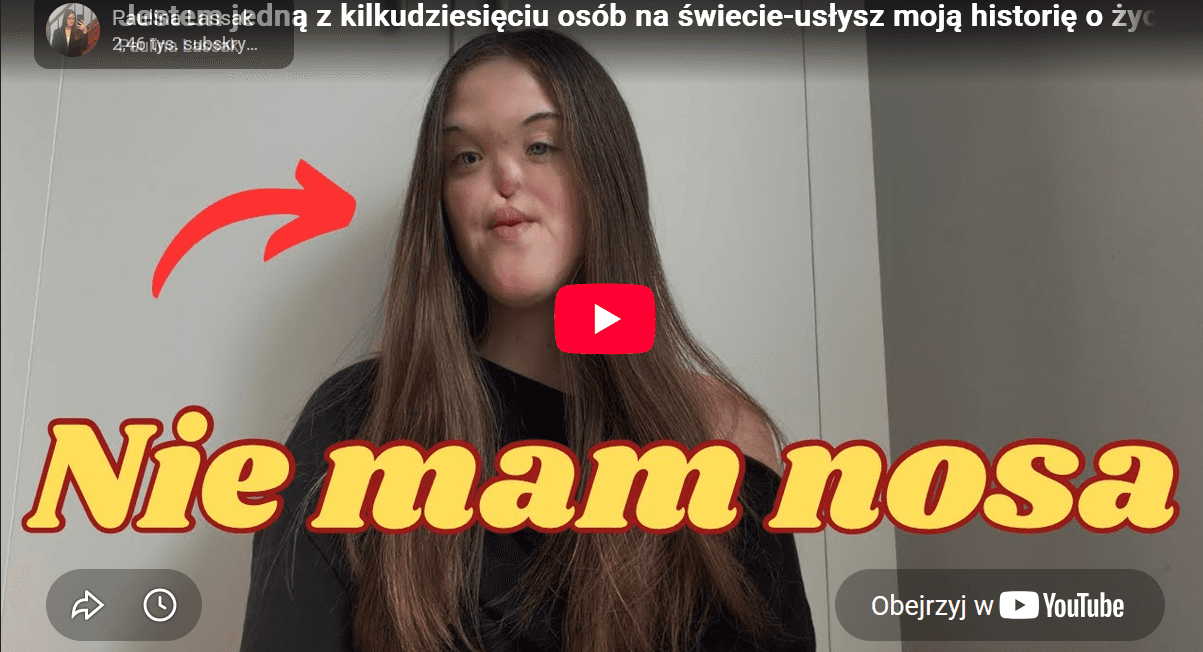 Urodzona bez nosa szuka ludzi którzy mogą pomóc.